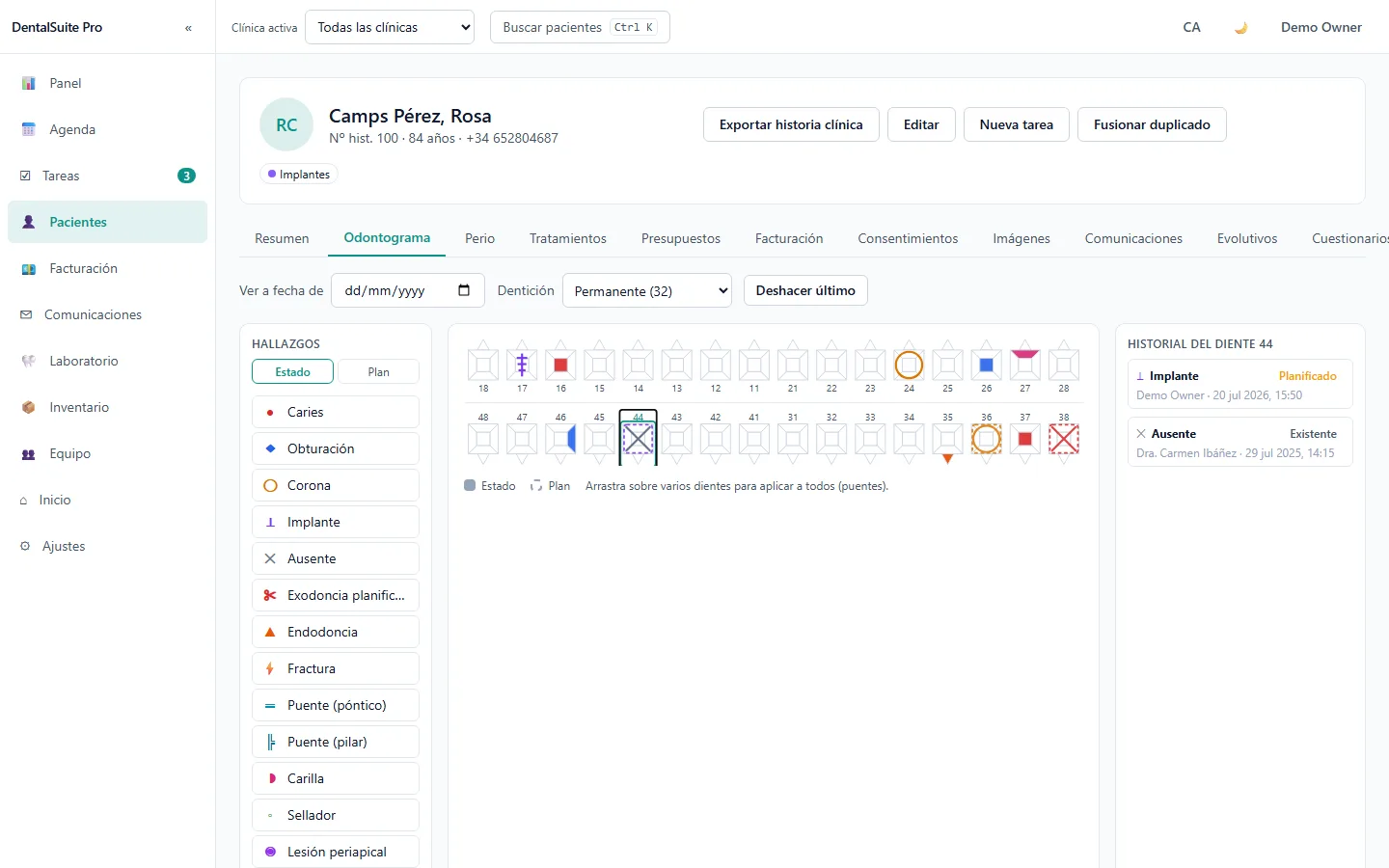 Odontograma de DentalSuite Pro